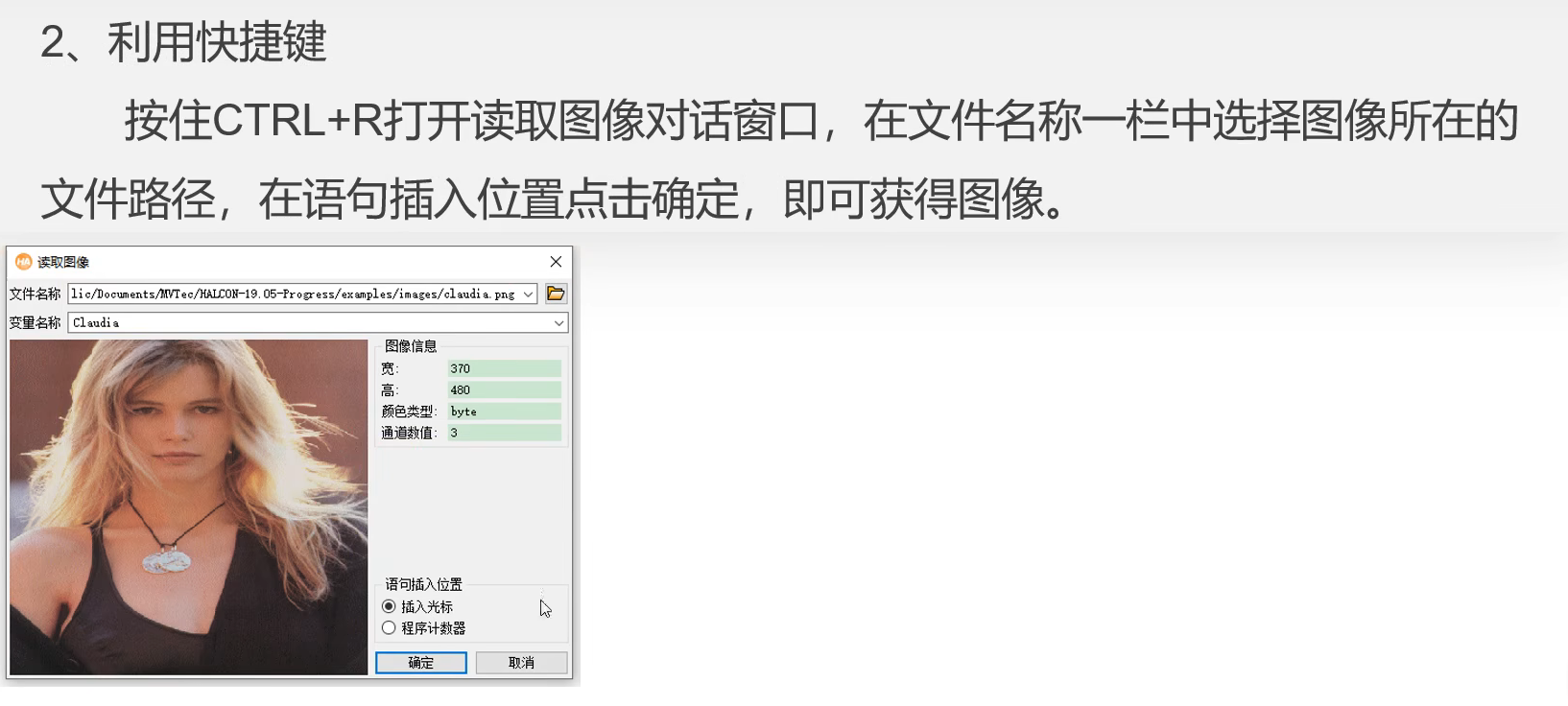 image-20240704154934659