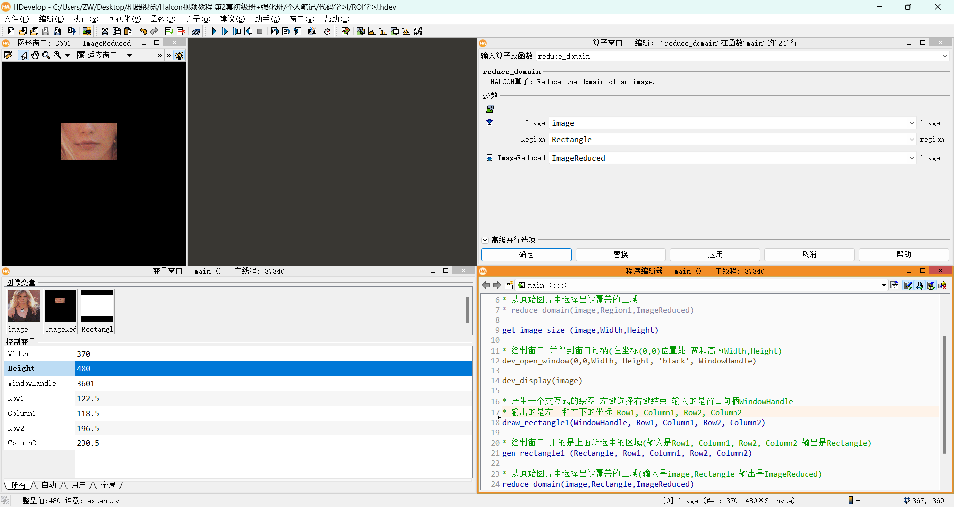 image-20240705111001641
